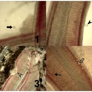 �@4�N����ˎ��5�N�������У��ķN���_���~������������Ч�أ�