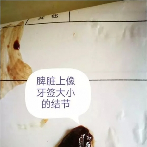 �m�Y���B��ϧ�۵�Ҫ���ܲ������g