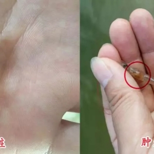 �������еı��ζ������ⶾ���J�屣���`�^��